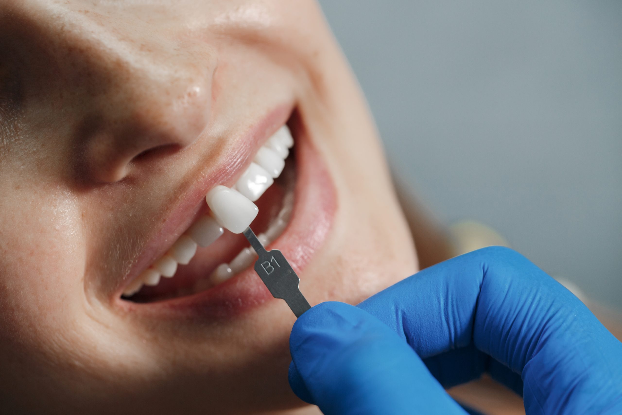 a teeth replacing